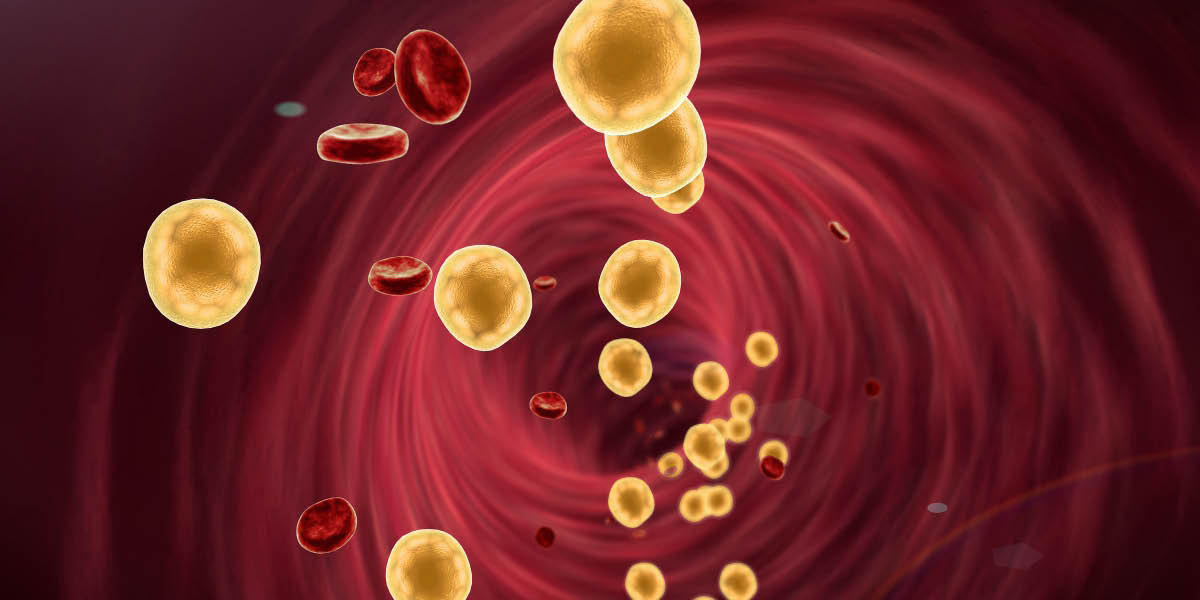 colesterol-menopausia