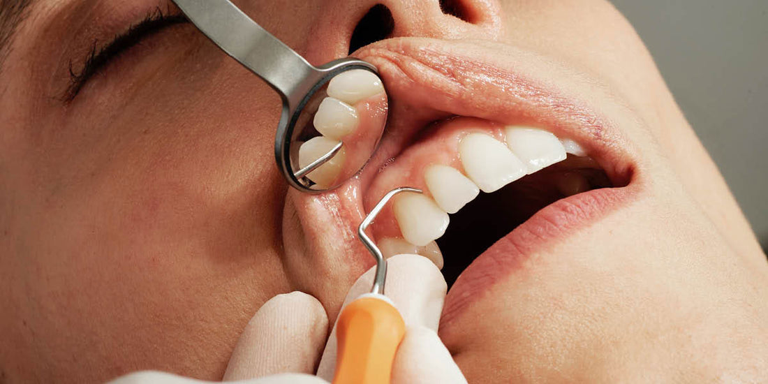 problemas-bucales-menopausia