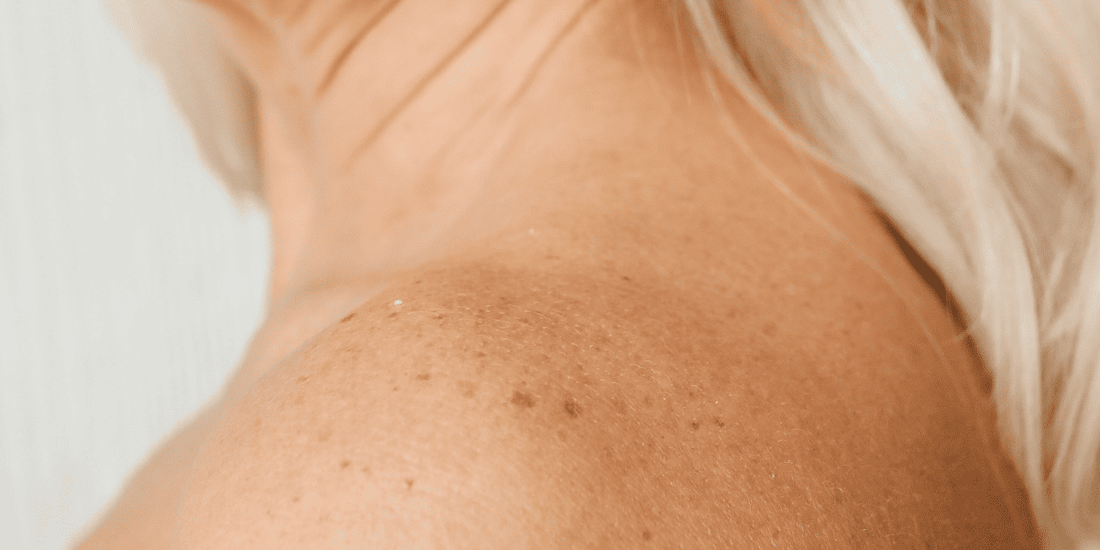 sol-manchas-y-arrugas-en-la-menopausia